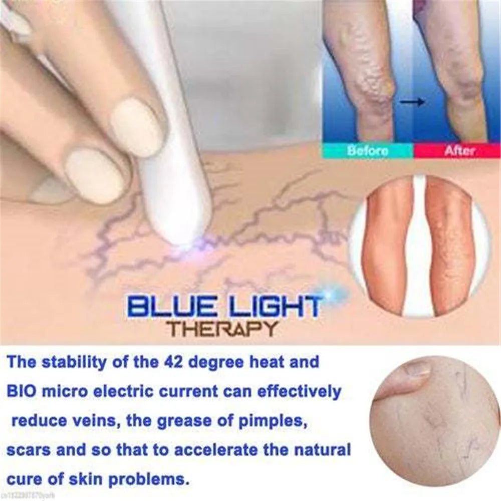 Acne/wrinkle removal Laser Pen