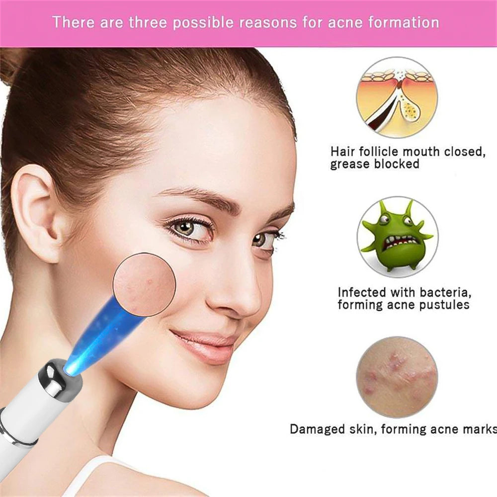 Acne/wrinkle removal Laser Pen